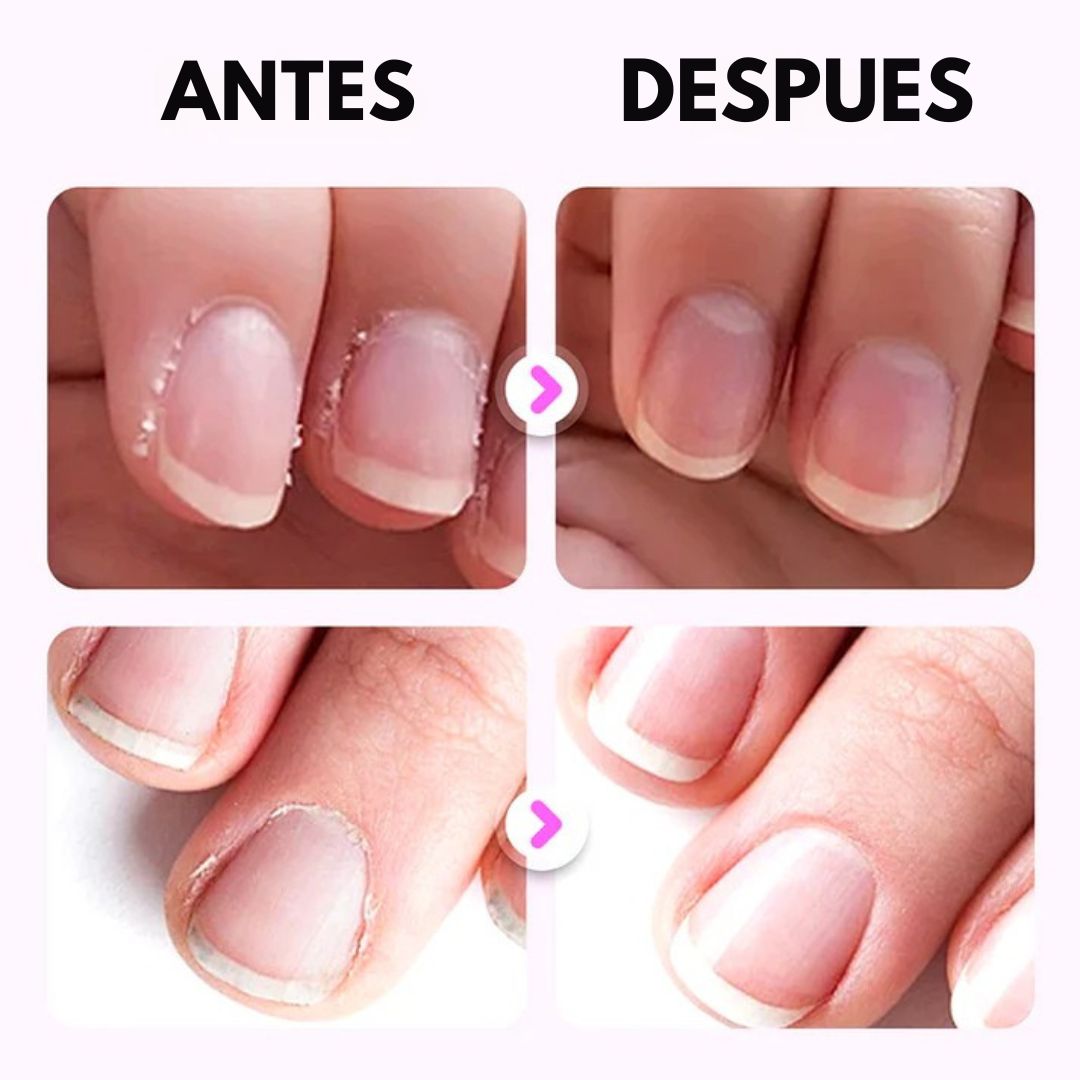 Lápiz 3-en-1 para uñas perfectas