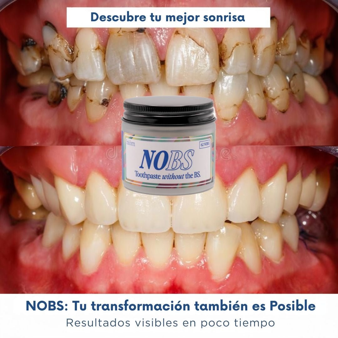 NOBS Tabletas de pasta de dientes - TodoBacano